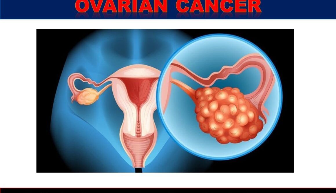 Diagnosing-Ovarian-Cancer (1)