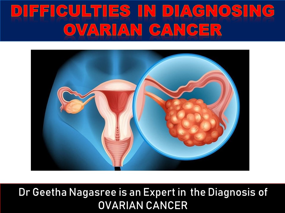 Diagnosing-Ovarian-Cancer