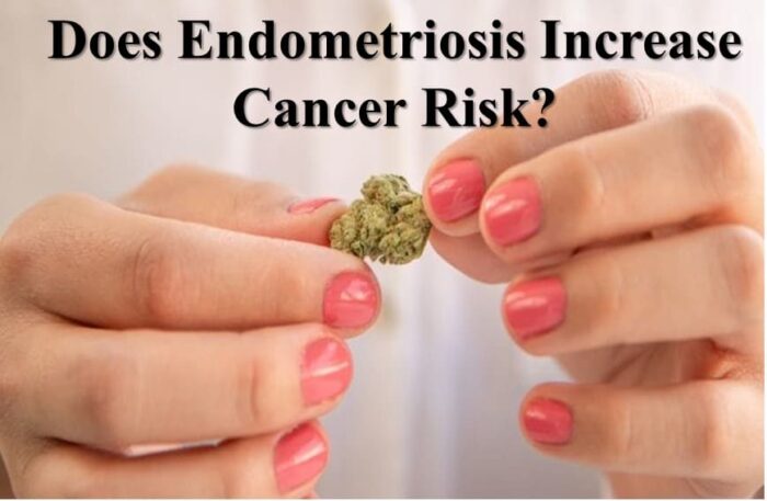 Does endometriosis increase cancer risk