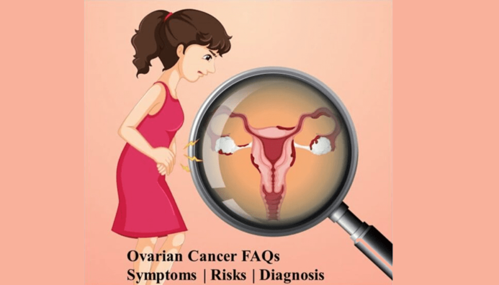 Ovarian Cancer FAQs | Symptoms | Risks | Diagnosis