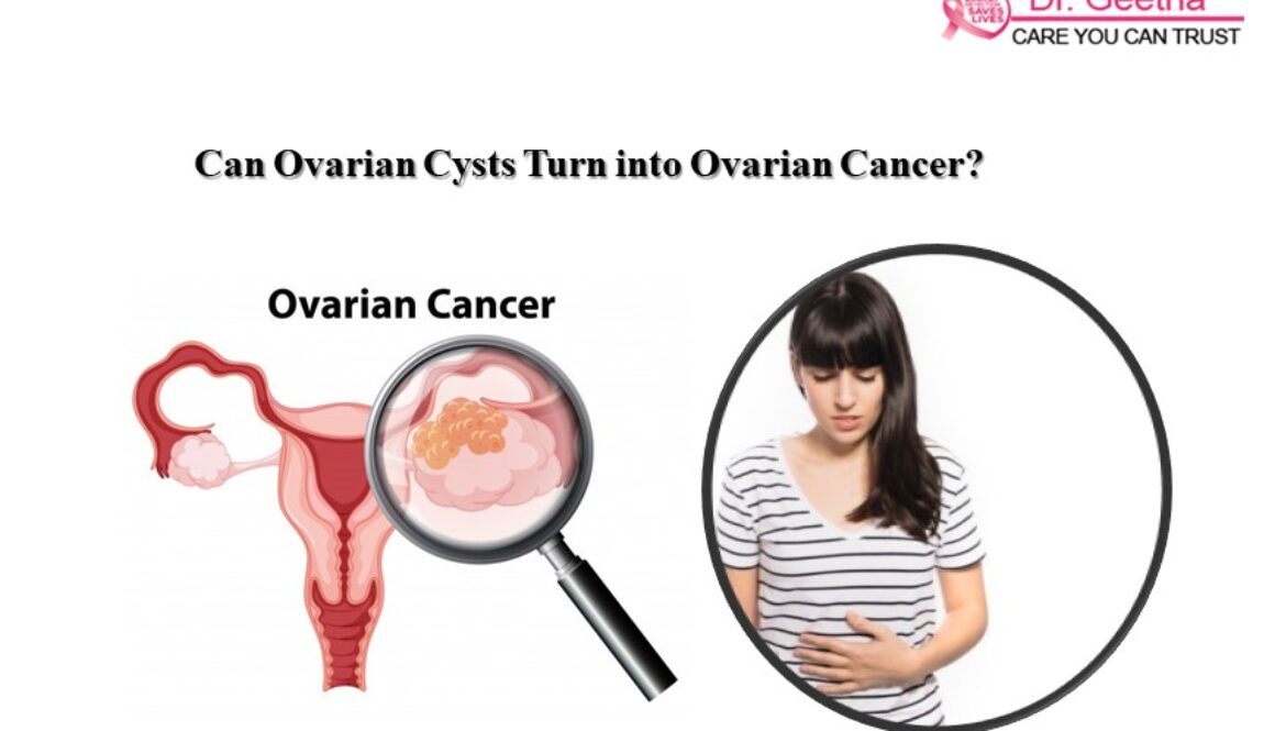 ovarian cancer vs ovarian cysts