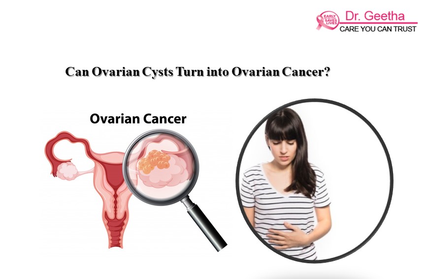 ovarian cancer vs ovarian cysts