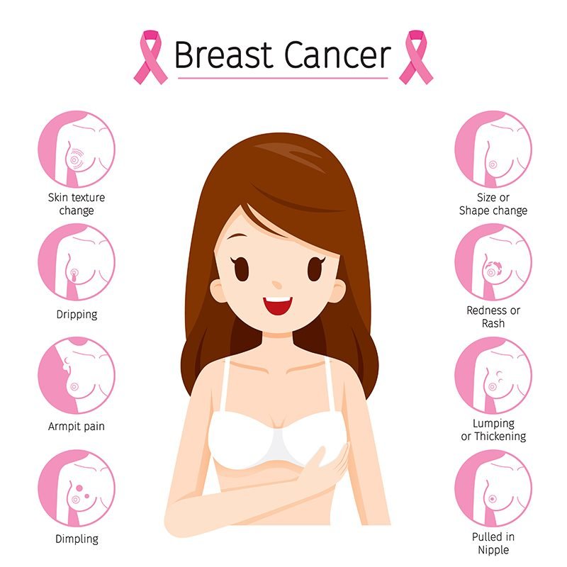 Breast Cancer Treatment